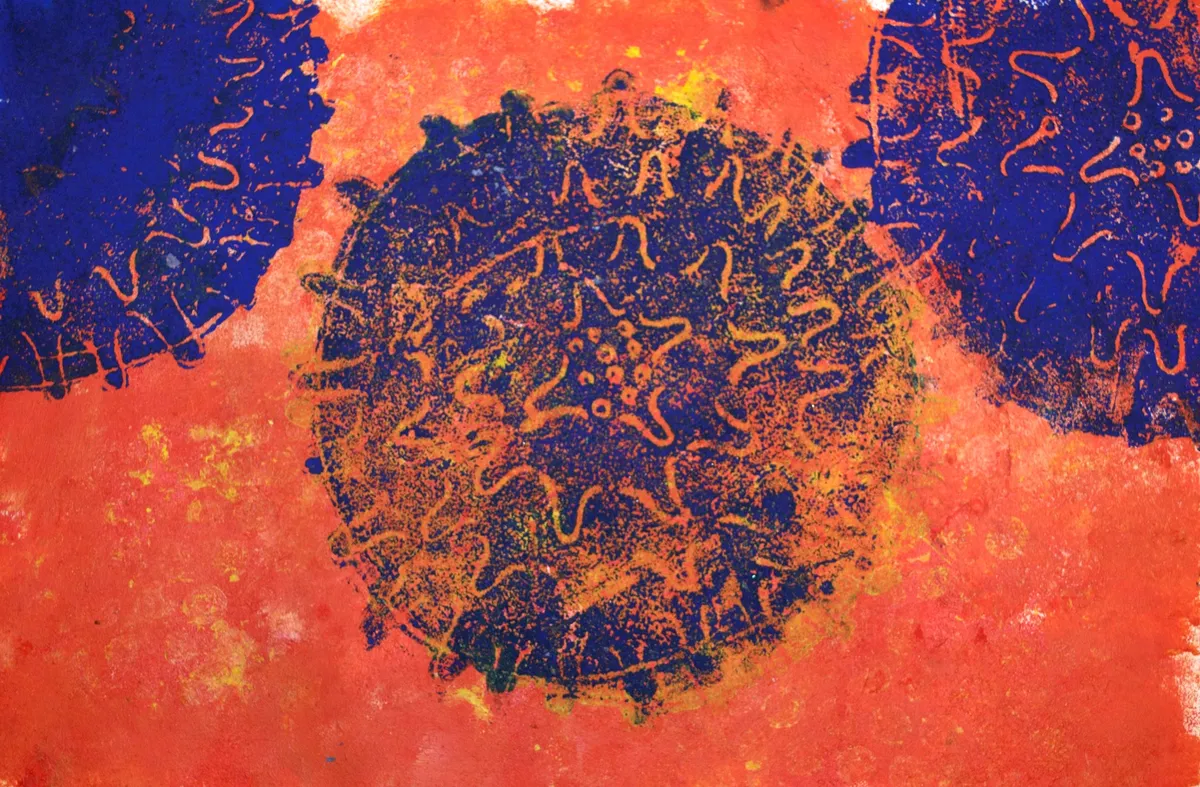 Как распознать симптомы коклюша?