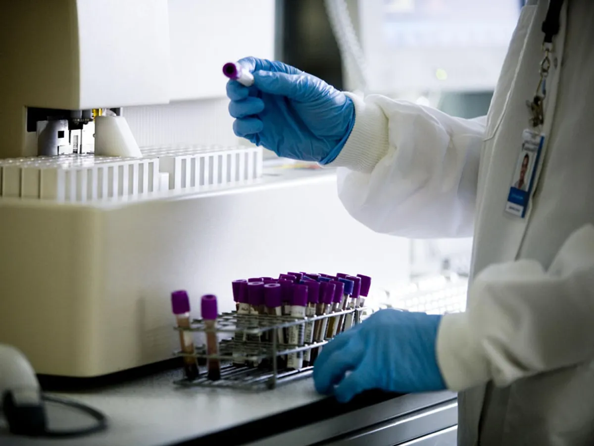 Діагностика і лікування коліту