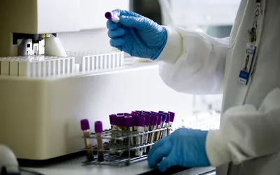 Діагностика і лікування коліту