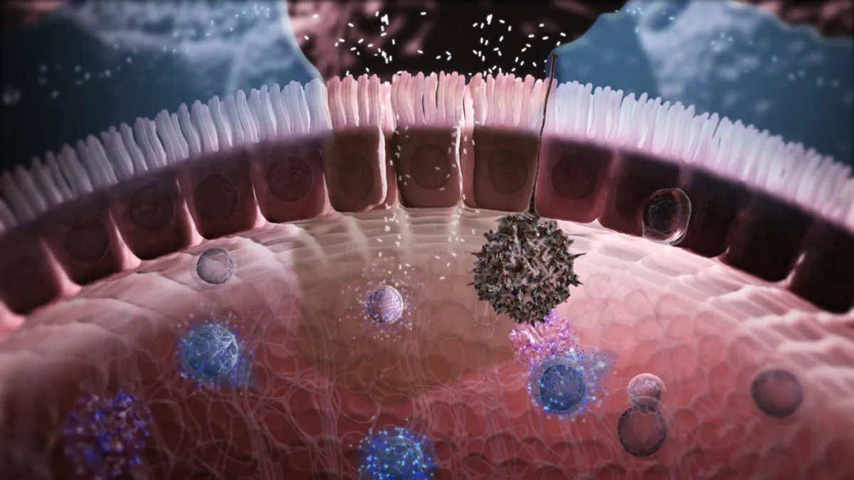 Откуда берется неспецифический язвенный колит и как его распознать?