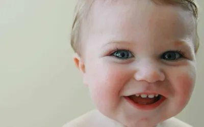 Как лечить потницу?