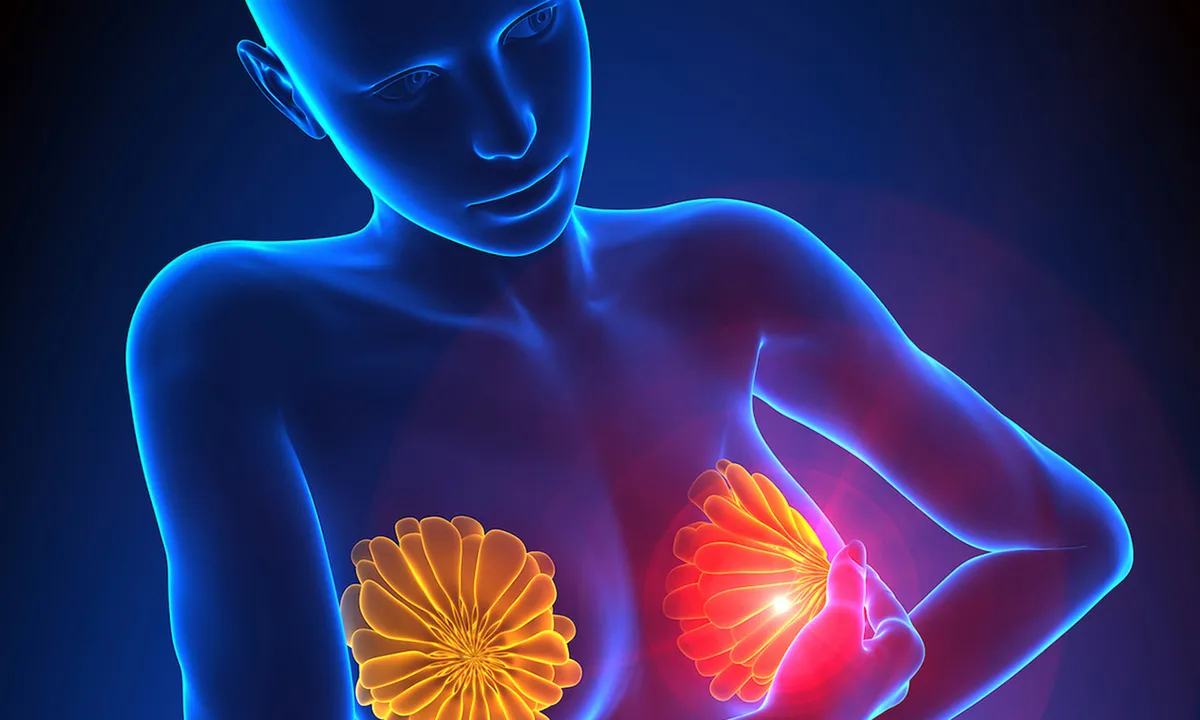 Что показывает УЗИ молочных желез?