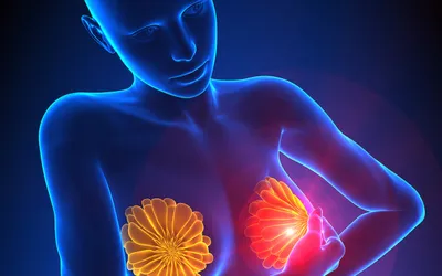 Что показывает УЗИ молочных желез?