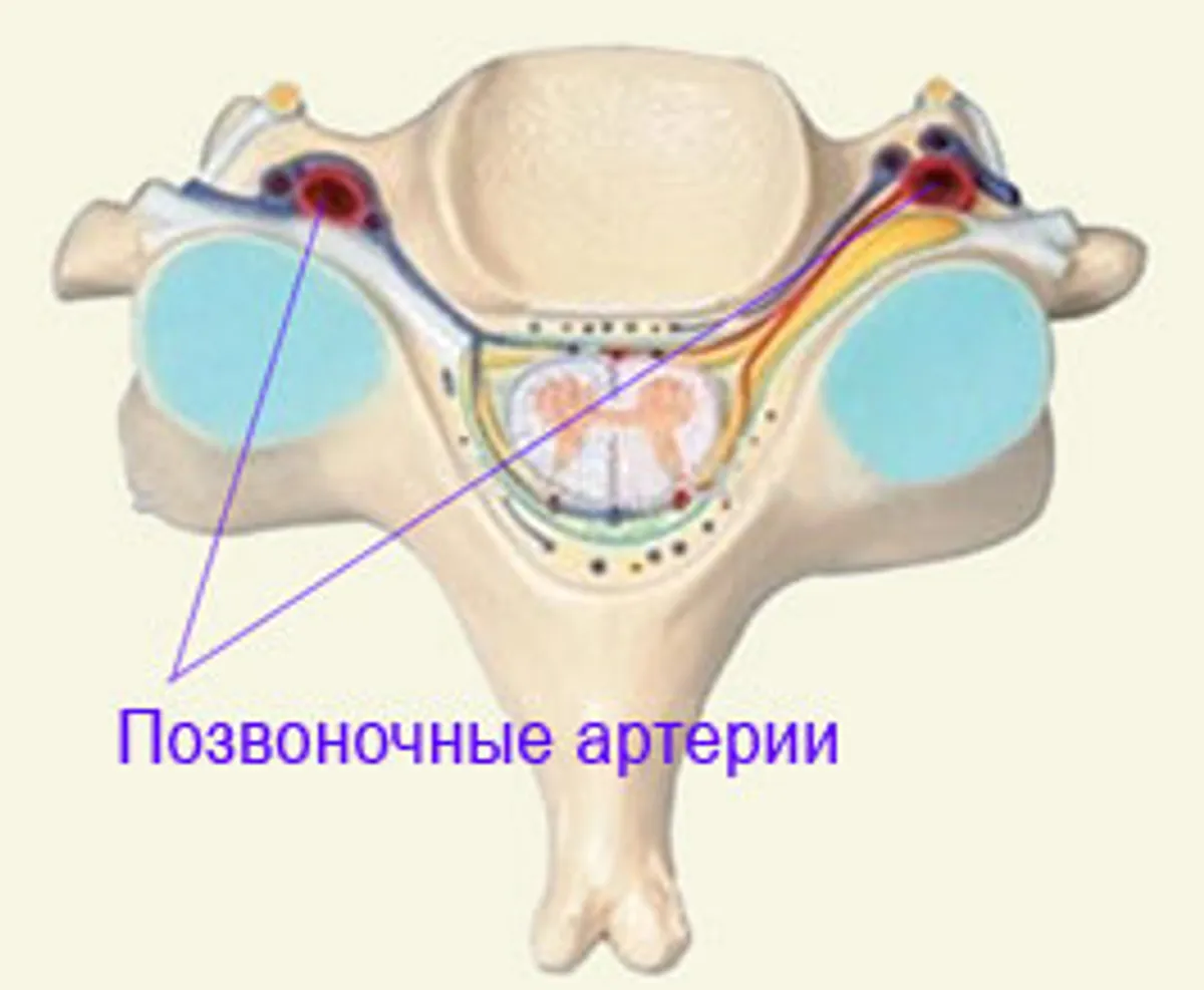 Остеохондроз позвоночника