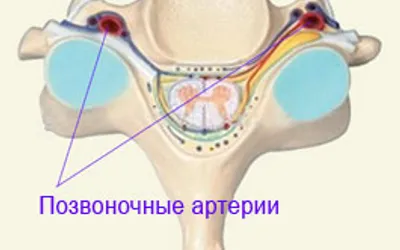 Остеохондроз позвоночника