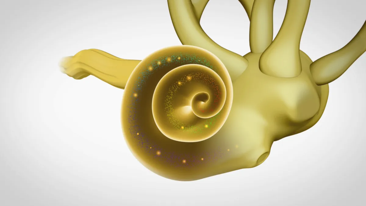 Что такое отосклероз и как его лечат?