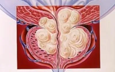 Угроза мужскому здоровью