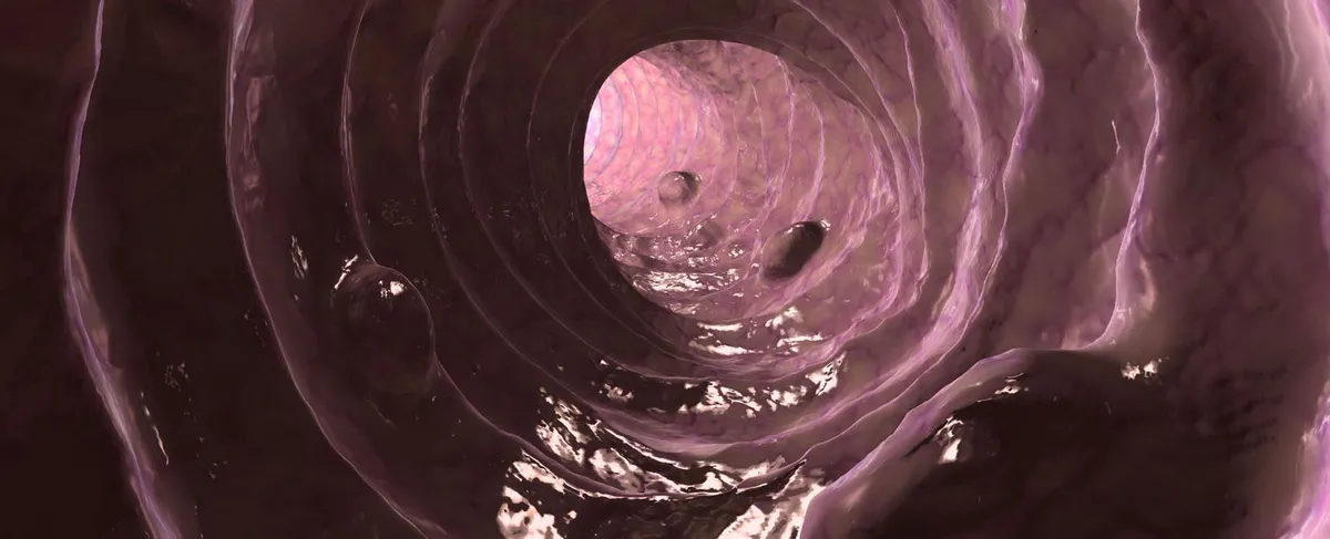 Почему колоноскопия кишечника – это лучшая профилактика рака толстой кишки