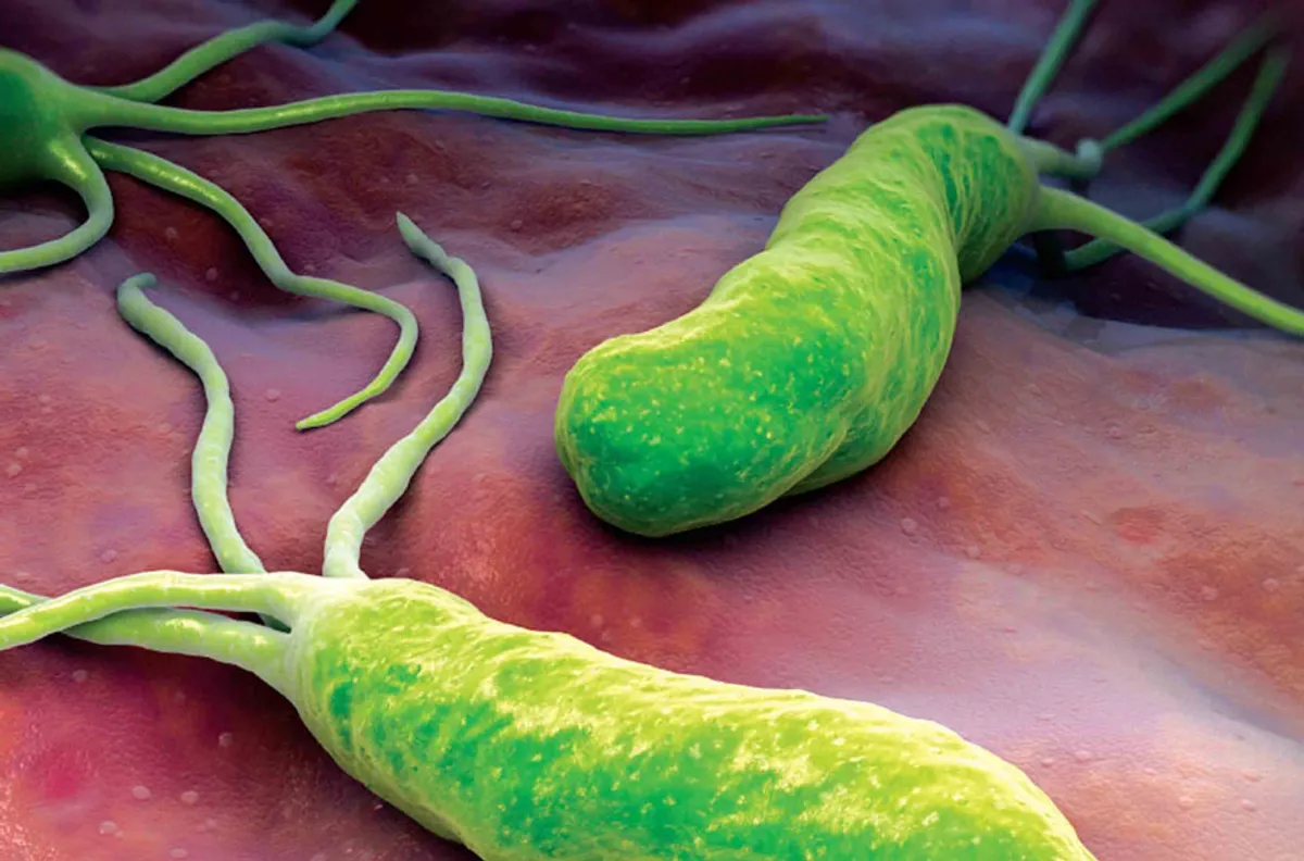 Що таке виразкова хвороба і як її лікують?