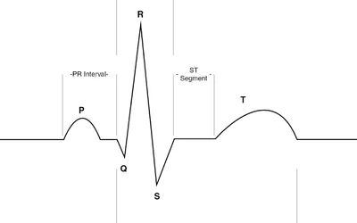 3 вида блокады сердца и как ее лечить?