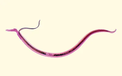 Откуда берутся глисты и что с ними делать?