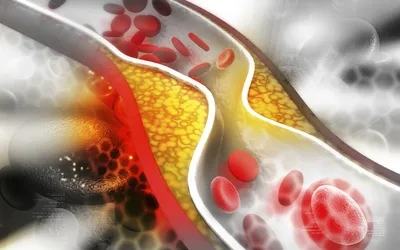 Біль у грудях: можливі причини і коли потрібно бити на сполох