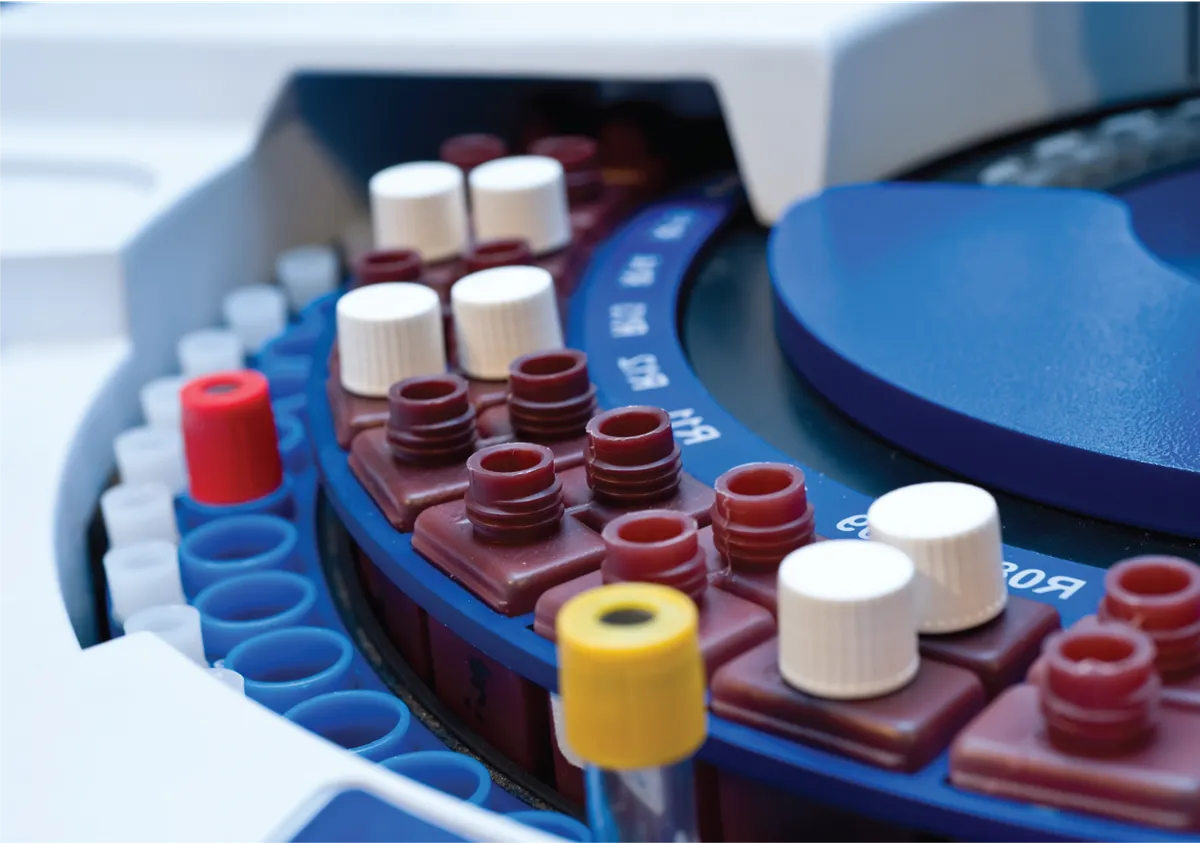 О чем расскажет анализ крови?