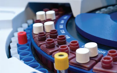 О чем расскажет анализ крови?