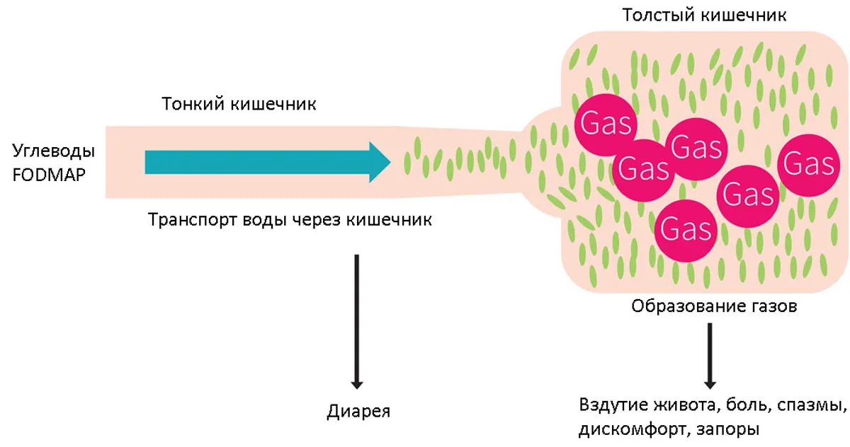 FODMAP диета при синдроме раздраженного кишечника